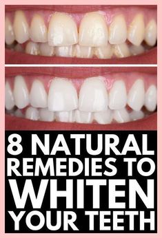 Repairing Receding Gums: A Guide to Restoring Your Gum Health. 

Best remedy for super white teeth within 5 minutes at home. Teeth Hygiene, Whiten Teeth Naturally, Whiten Your Teeth At Home, Clean Baking Pans, Tooth Whitening, Whitening Teeth, Whiten Your Teeth, Cleaning Painted Walls, Whitening Products