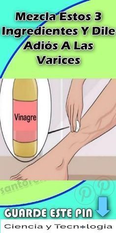 ✅✅Las varices o venas varicosas son venas inflamadas que suelen aparecer en las piernas ya sea por el embarazo, el envejecimiento..e ofrecemos varios consejos, remedios naturales y trucos #naturalbeautyremedies #naturalremedy #homemaderemedies#NaturalRemedies #dileadiósvarices#quitarvenasvaricosas#varicoseveins #arañas#remediosnaurales#remedioscaseros#varices y #arañitas Home Remedies For Spiders, Lose 40 Pounds, 3 Ingredient, Home Remedies, Cider, Natural Remedies, Healthy Life, Health Tips