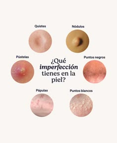 Tu Guía Rápida para Identificar Imperfecciones en la Piel 🤍 Brow Master, Esthetician Inspiration, Skin Picking, Med Spa, Cosmetology, Esthetician, Beauty Salon, Ideas De Fondos De Pantalla, Skin Care Routine