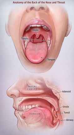 the anatomy of the mouth and throat, with labels on how it is used to treat