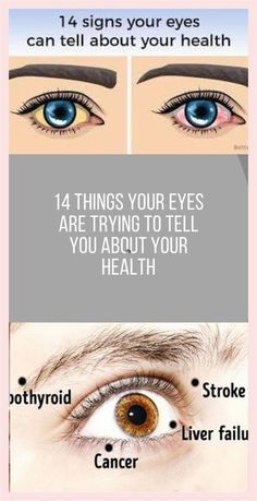 Smashing tips Eyes Health, Coconut Health, Salt Benefits, Remove Skin Tags Naturally, Roller Workout, Frosty Recipe, Guided Relaxation, Tea Health, Banana Drinks