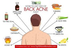 How to Get Rid of Back Acne Fast | Top 10 Home Remedies Get Rid Of Back Acne, Rid Of Back Acne, Cystic Acne Remedies, Acne Home Remedies, Back Acne, Skin Care Routine For 20s, Remedies For Acne, Natural Acne Remedies, Home Remedies For Acne