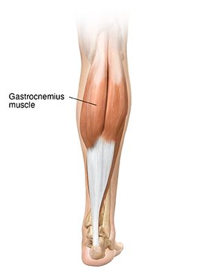 Understanding Gastrocnemius Muscle Tear | Saint Luke's Health System Gastrocnemius Muscle, Muscle Tear, Dynamic Stretching, Compression Sleeves, Calf Muscles, Stretching Exercises, Lower Leg, Health System, Blood Flow