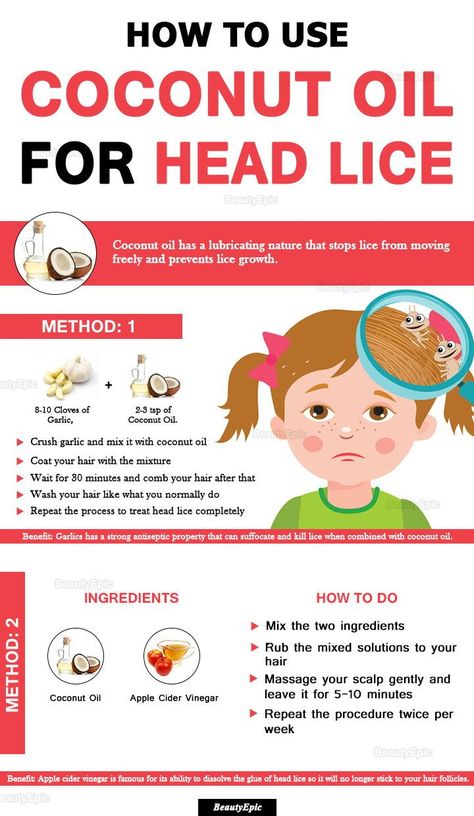 How To Use Coconut Oil for head lice Lice Remedies, Coconut Oil Moisturizer, Coconut Oil Lotion, Coconut Oil Hair Growth, Coconut Oil For Teeth, Diy Coconut Oil, Coconut Oil For Acne, Coconut Oil Skin Care, Coconut Oil Hair Mask