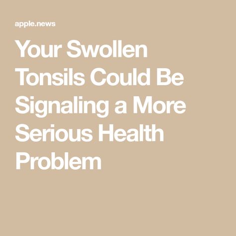 Your Swollen Tonsils Could Be Signaling a More Serious Health Problem Remedies For Swollen Tonsils, Swollen Tonsils, Strep Throat, Sick Remedies, Sciatic Nerve Pain, Home Health Remedies, Nerve Pain, Home Health, A Doctor