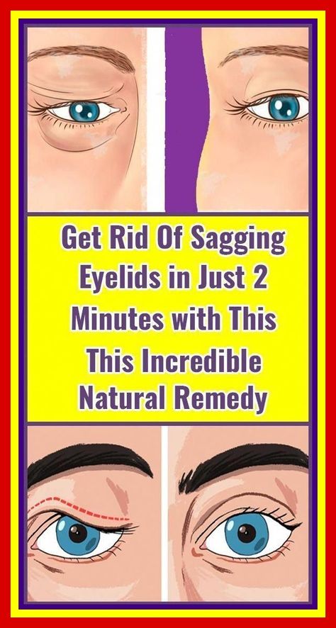 Get Rid Of Saggy Skin, Saggy Eyelids, Tighten Stomach, Sagging Eyelids, Art Cook, Bumps On Skin, Skin Bumps, Vegan Holiday, Under The Skin