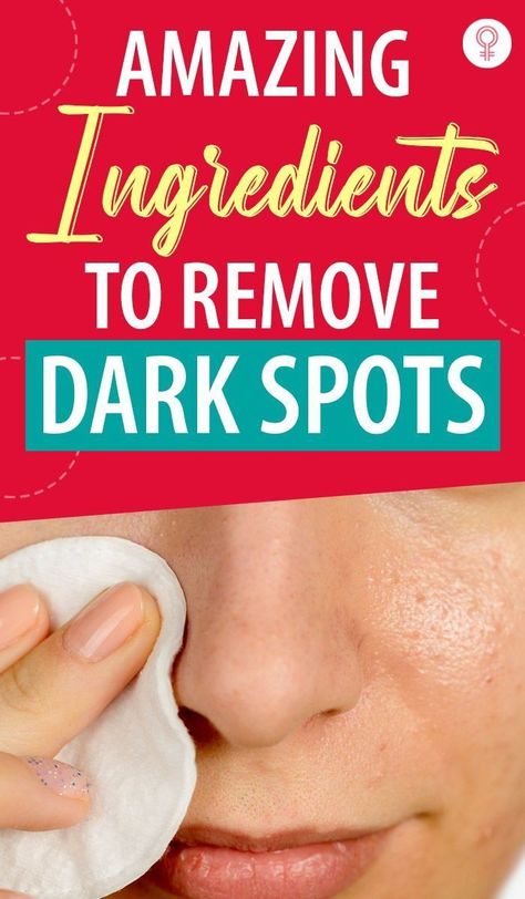 Dark Spots Remedies, Dark Spots On Face, Brown Spots Removal, Brown Spots On Face, Spots On Face, Lighten Dark Spots, Skin Condition, Remove Dark Spots, Fade Dark Spots