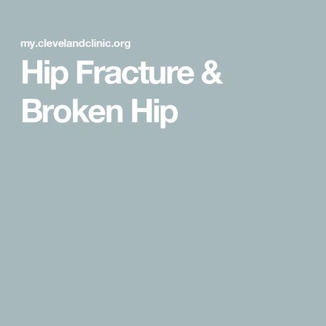 Hip Fracture & Broken Hip Hip Fracture, Hip Surgery, Bone Loss, Cleveland Clinic, Hip Pain, The Signs, How To Stay Healthy, Disease, The Top