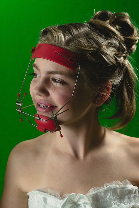 Diy Headgear Braces Costume, Christmas Braces, Perfect Teeth Braces, Head Gear Braces, Fashion Braces, Braces Cute, Headgear Braces, Braces Aesthetic Power Chain, Overjet Overbite Braces Before And After