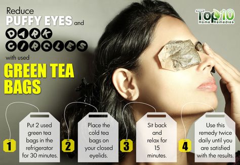 Dry Eyes Causes, Swollen Eyes, Eye Puffiness, Green Tea Bags, Under Eye Puffiness, Dark Circles Under Eyes, Eyes Problems, Mascara Facial, Dry Eyes