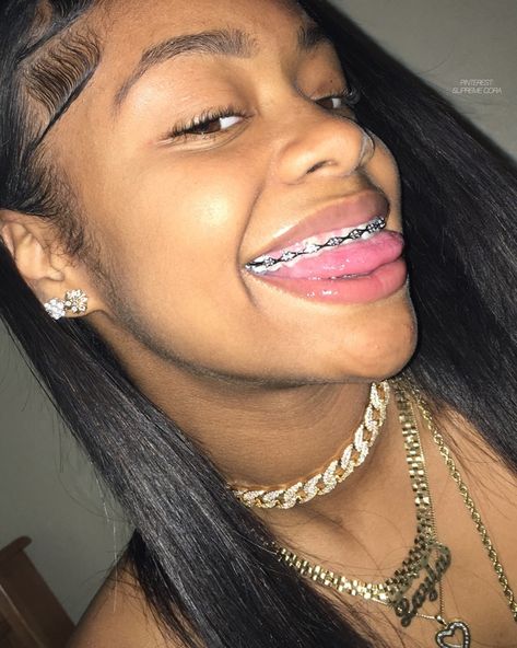 #braceface Power Chain Braces, Pink Braces, Green Braces, Braces Colors Ideas, Jewelry Teeth, Teeth Gems, Black Braces, Cute Braces Colors