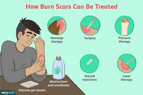 Treat Burns, Hypertrophic Scars, Burn Injury, Skin Grafting, Facial Plastic, Laser Therapy, Scar Tissue, Tolu, Silicone Gel