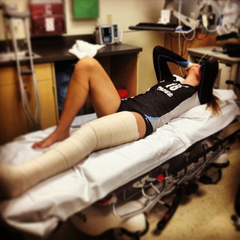 Broken Leg In Hospital, Leg Surgery, Broken Leg Cast, Long Leg Cast, Orthopedic Brace, Arm Cast, Broken Foot, Leg Cast, Hospital Admit Hand Pics