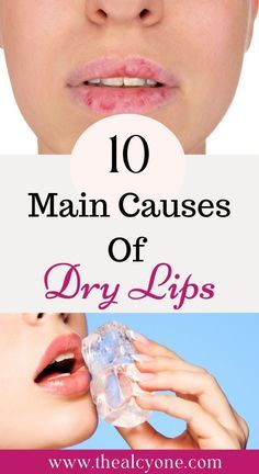 Dry Lips Remedy, Chapped Lips Remedy, Very Dry Lips, Dry Cracked Lips, Lip Care Routine, Cracked Lips, Peeling Skin, Smooth Lips, Chapped Lips