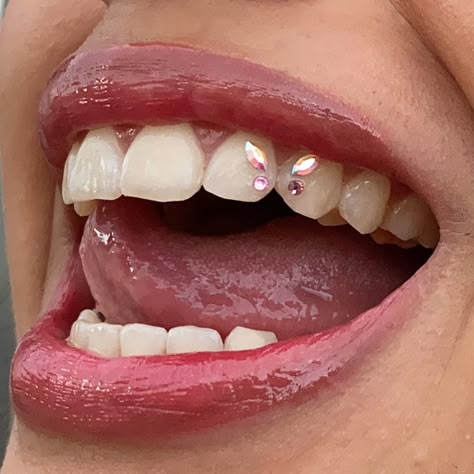 Butterfly Tooth Gems Ideas, Butterfly Teeth Gem, Bedazzled Teeth, Pink Tooth Gem, Butterfly Tooth Gem, Teeth Gems, Butterfly Cute, Tooth Charm, Tooth Gems