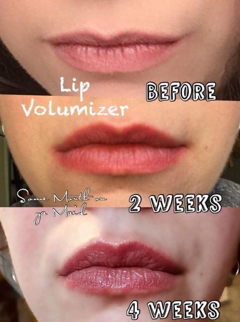 Plump up the volume and get lasting results of full, pouty lips without the use of irritants. The proprietary formula is based on the most advanced lip plumping technologies, plumping lips from the inside out. Get the benefits of collagen injections without the needles! Bigger Lips Naturally, Plumping Lips, Collagen Injections, Benefits Of Collagen, Pouty Lips, Collagen Benefits, Lip Plumping, Lip Injections, Free Tips