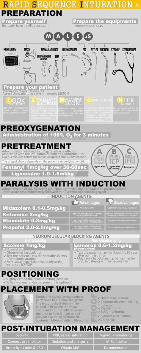 Rapid Sequence Intubation 7 RSI Rsi Medications, Anesthesia School, Nurse Anesthesia, Paramedic School, Medical Mnemonics, Nurse Study Notes, Nursing Mnemonics, Medical Student Study, Nursing School Survival