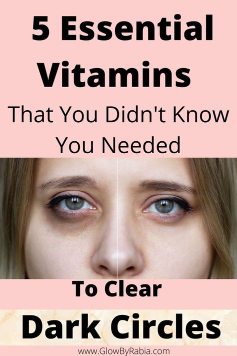 under eye dark circles Remove Eye Wrinkles, Eye Bag Remedies, Eyes Skin Care, Eye Health Remedies, Under Eye Dark Circles, Andra Day, Eye Dark Circles, Dark Circles Around Eyes, Under Eye Fillers