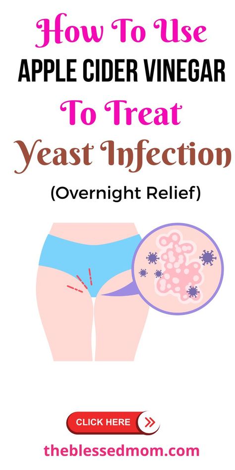 apple cider vinegar for yeast infection Acv For Yeast Infection, Acv Bath, Bath For Yeast Infection, Yeast Infection During Pregnancy, Apple Cider Vinegar Bath, Treat Yeast Infection, Yeast Infection Symptoms, Yeast Infections, Soothing Bath