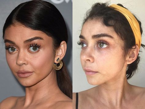 Photos: What actresses look like without makeup Without Makeup Look, Plastic Surgery Makeup, Surgery Makeup, Celebrities No Makeup, Plastic Surgery Aesthetic, Skincare Routine Aesthetic, Photoshop Makeup, Surgery Aesthetic, Healthy Body Image