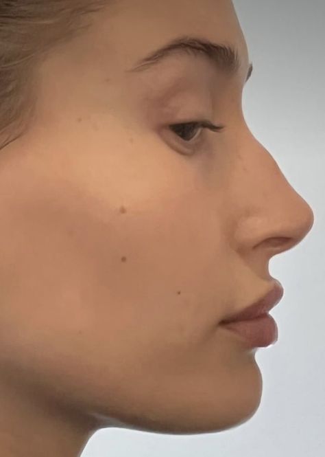 Nose Types Front View, Bump Nose Side Profile, Hooked Nose Celebrities, Bump Nose Aesthetic, Big Ears Models, Crooked Nose Side Profile, Low Nose Bridge Face, Bump Nose Bridge, Pointy Nose Side Profile