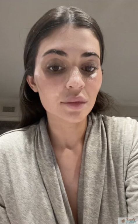 Kylie Jenner Without Makeup, Kylie Without Makeup, Kylie Jenner No Makeup, Face No Makeup, Real Skin Texture, No Makeup Pictures, Kylie Jenner Face, Suntanned Skin, Migos Rapper