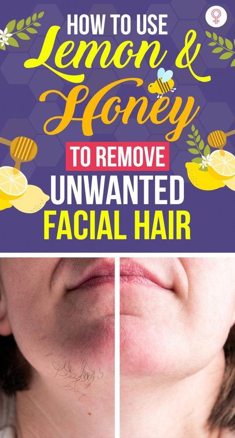 Are you suffering from unwanted facial hair? Then, your wait is over. Click here to learn how to get rid of facial hair with simple and effective home remedies. Natural Hair Remover For Face, Homemade Hair Removal, Natural Facial Hair Removal, Facial Hair Removal For Women, Hair Sticking, Lemon And Honey, Face Hair Removal, Unwanted Hair Permanently, Best Hair Removal Products