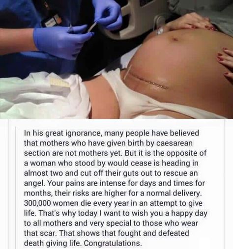 Birth Giving, Baby Captions, Mama Quotes, Emergency C Section, Pregnancy Belly Photos, Mommy Quotes, Baby Life Hacks, Medical School Essentials, Baby Facts