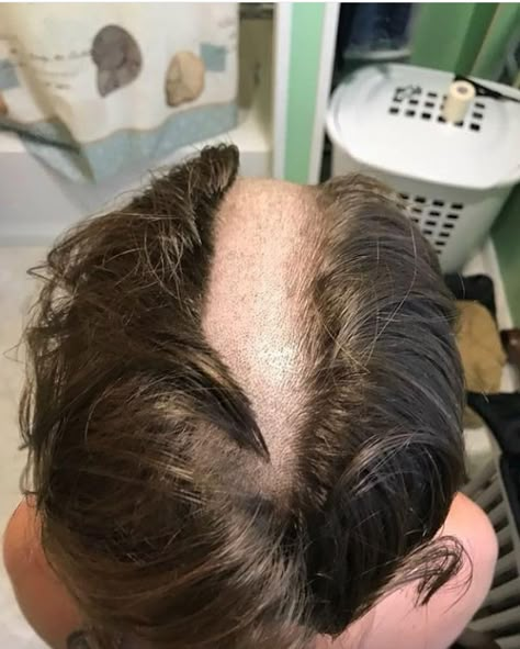 Mid Haircut, Summer Haircuts For Women, Hair On The Floor, Female Mohawk, Shaved Hair Women, Shaving Head, Slicked Hair, Forced Haircut, Easy Updo Hairstyles