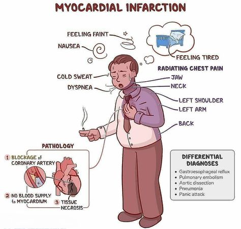 Medications Nursing, Holistic Nursing, Feeling Faint, Nursing Classes, Med Surg Nursing, Cardiac Nursing, Nursing School Survival, Nursing School Notes, Heart Muscle