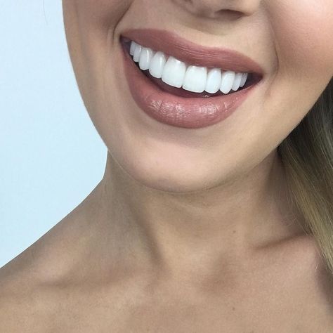 A lot of you have been asking about my teeth recently and if I've changed them! I upgraded from composite veneers to porcelain veneers as that was always the goal for me; I wanted to trial how they'd look without having to commit to the permanency of porcelains so I opted for composites first! As always the one and only @drangelolazaris was to thank he's the only person I'd ever trust with my teeth. As far as cost goes it's calculated on a case-by-case basis and every case is different! @drangel Natural Teeth Whitening Diy, Snap On Smile, Teeth Covers, Composite Veneers, Best Toothpaste, Veneers Teeth, Teeth Whitening Diy, Filmy Vintage, Beautiful Teeth