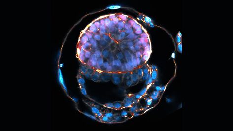 Lab-engineered human embryo models created from stem cells provide a look at development beyond the first week. But they raise ethical questions. Ethical Questions, Human Embryo, What Is Human, Stem Cell Research, The Mimic, Self Organization, University Of Cambridge, Actor Picture, Human Development