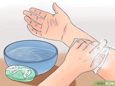 How to Heal a Wound Fast (with Pictures) - wikiHow Heal Wounds Faster, How To Heal Burns, Cotton Swab, Wound Healing, Band Aid, Healing Process, Cleaning Clothes, Home Remedies, Make Sure