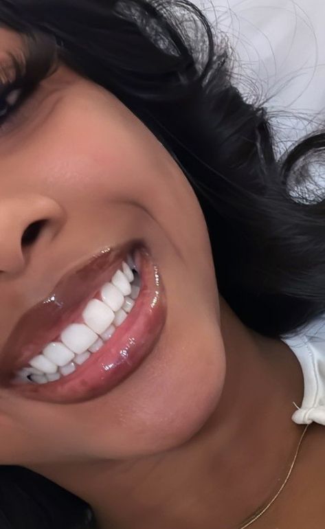 Nice Smile Teeth Black Women, Plastic Surgery Black Women, Invisalign Black Women, Straight Teeth Black Woman, Rhinoplasty Black Women, Botox Black Women, White Teeth Black Women, Pretty Teeth Black Women, Crooked Teeth Pretty