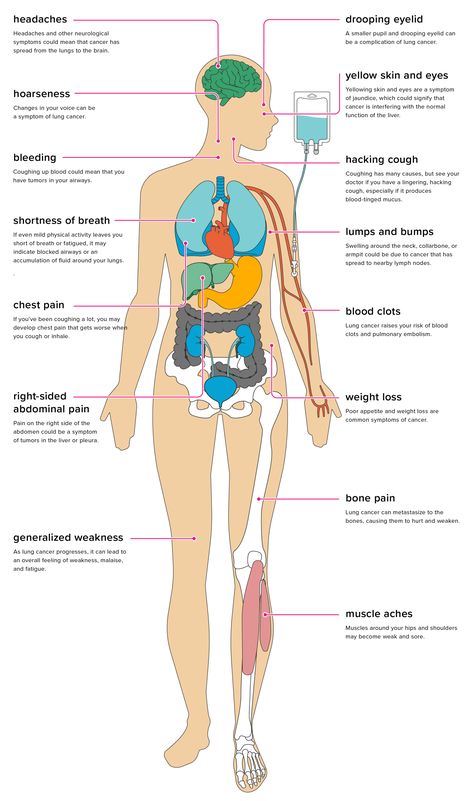 Insomnia Causes, Memory Problems, Lack Of Energy, Loose Skin, Lack Of Sleep, Sleep Deprivation, Side Effects, Better Sleep, Back Pain