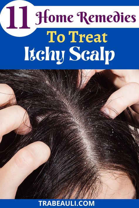 What are the Reasons for Itchy Scalp?
Let us check out. Scalp Moisturizer Diy, Itchy Scalp Remedy, Hair Growth Mask Diy, Dandruff Causes, Itchy Skin Remedy, Home Remedies For Dandruff, Clean Scalp, Hair Dandruff, Scalp Conditions