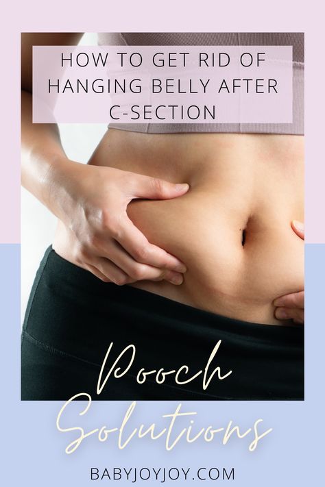 Are you wondering how you can safely get rid of that hanging belly after your c-section? We have got you covered! Discover our best pooch solutions to help you regain your confidence. Learn more here! #newborn #baby #newmom #newbornbaby #motherhood #parenthood #positiveparenting #mom #newparent #parentingtips #parentingadvice C Section Belly Get Rid Of, C Section Pooch, Belly After C Section, Get Rid Of Hanging Belly, C Section Pouch, Belly Apron, C Section Belly, Cut Belly Fat, Belly Binding