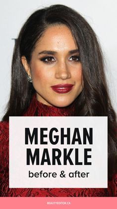 Meghan Markle Curly Hair, Meghan Markle Nose Job, Meghan Markle Natural Hair, Meghan Markle Ex Husband, Meghan Markle Young, Meghan Markle House, Meghan Markle Plastic Surgery, Meghan Mark, Meghan Markle Hair