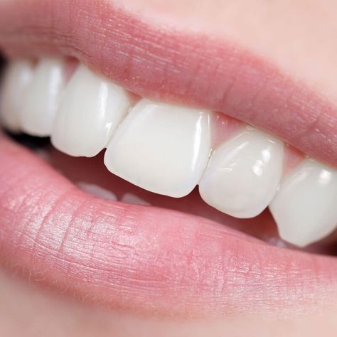 5 Ways How to Heal Cavities Naturally Heal Cavities Naturally, Reverse Cavities, Esential Oils, Homemade Toothpaste, Heal Cavities, Ways To Heal, Dental Cavities, Essential Oils For Pain, Yl Oils