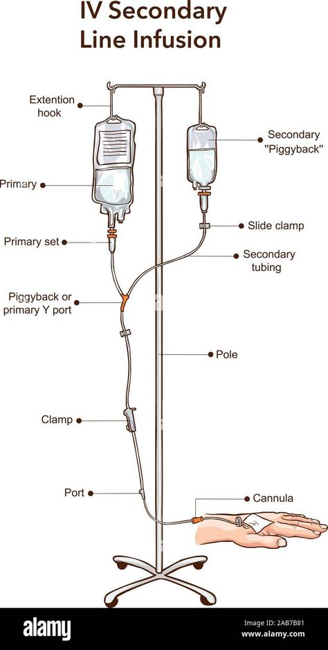 Nursing Iv, Intravenous Drip, Iv Line, Arm Drawing, Central Line, Iv Infusion, Iv Fluids, Seasons Posters, Pediatric Nursing