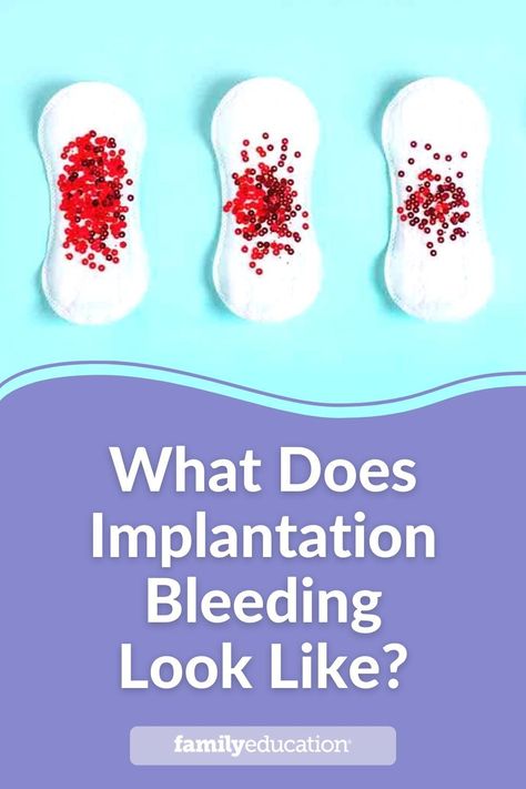 We explain what implantation bleeding looks like and why women experience spotting or bleeding in early pregnancy. #implantationbleeding Implantation Bleed Vs Period, Benefits Of Folic Acid, Implantation Symptoms, Spotting During Pregnancy, Pregnancy Spotting, 6 Weeks Pregnant, Period Blood, Ovulation Cycle, Home Pregnancy Test