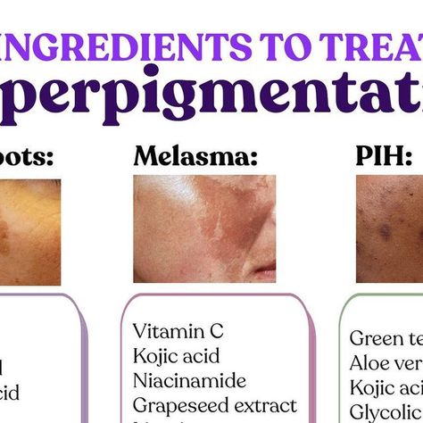 Clinikally on Instagram: "👆The cheat sheet to hyperpigmentation from our dermatologists ✨  SAVE THIS BEFORE IT DISAPPEARS 📥  𝐰𝐰𝐰.𝐜𝐥𝐢𝐧𝐢𝐤𝐚𝐥𝐥𝐲.𝐜𝐨𝐦  . . .  #HyperpigmentationTreatment #HyperpigmentationSolution #skincare #SkincareProductsThatWork #ProductRecommendation #SkincareforAll #SkincareGoals #SkincareTips #MedicalSkincare #SkinExperts #SkincareIndia #KojicAcidCream #KojicAcidSkincare #SkincareDaily #SkincareOnline #SkincareEssentials #BudgetSkincare #PharmacyProducts #VitaminCSkincare #DermatologistSkincare #BrighteningSkincare #SalicylicAcid #Hyperpigmentation #melasmatreatment" Skin Care Cheat Sheet, Skincare Cheat Sheet, Skincare For Hyperpigmentation, Hydrating Face Mask Diy, Skincare Budget, Dry Skin Diy, Dermatologist Skin Care, The Cheat Sheet, Forehead Acne