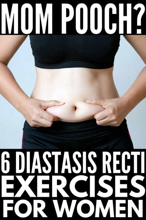 Goodbye Mummy Tummy! | If you're looking for a workout plan to help you get rid of your mom pooch, we're sharing 6 core strengthening diastasis recti exercises for women! No more hiding behind oversized clothes - these core strengthening workouts will tighten and tone your core for a flat belly you'll be proud to show off! Commit to the challenge and don't forget to take before and after photos to track your progress! Mom Pooch, Mom Tummy, Healing Diastasis Recti, Mummy Tummy, Mom Belly, Diastasis Recti Exercises, Exercises For Women, Strengthen Core, Diastasis Recti