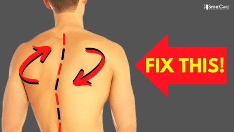 Lower Back Stiffness, Gluteus Medius Exercises, Hip Alignment, Better Posture Exercises, Back Posture, Lower Back Pain Exercises, Muscle Imbalance, Lower Back Pain Relief, Myofascial Release