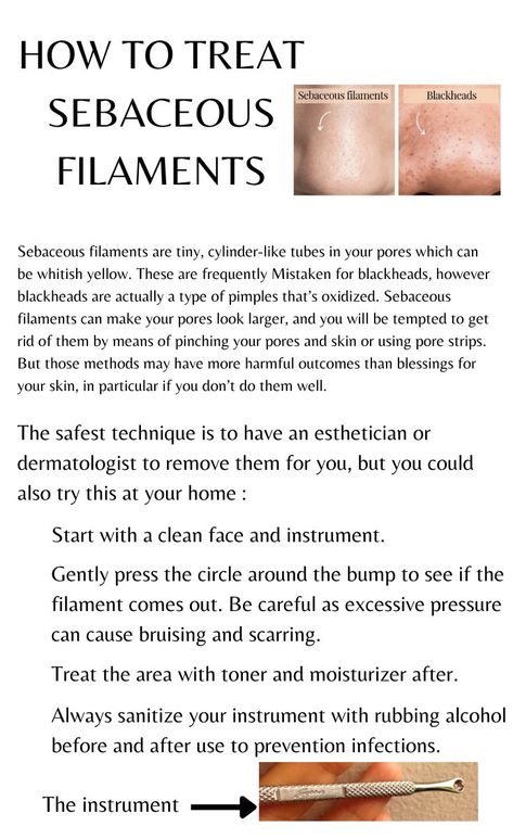 sebaceous filaments the ordinary |
sebaceous filaments products |
sebaceous filaments nose treatment |
sebaceous filaments removal tool |
sebaceous filaments treatment dermatologist |
sebaceous filaments home remedy Nose Pores Remedy, Sebaceous Filaments How To Get Rid Of, Sebaceous Filaments Skincare, Sebatious Filaments, How To Get Rid Of Sebaceous Filaments, Sebaceous Filaments Removal, Body Knowledge, Sebaceous Filaments, Different Types Of Acne