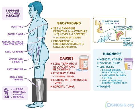 Cushing Syndrome, Facial Swelling, Hospital Medicine, Cushings Syndrome, High Cortisol, Medical Student Study, Pituitary Gland, Muscle Weakness, Medical Studies