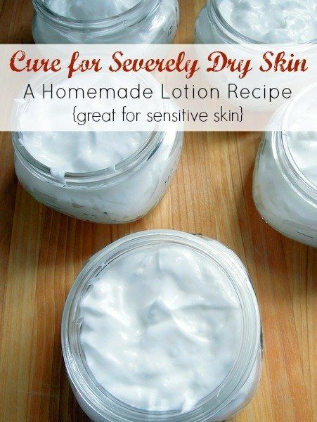 Homemade Lotion Recipe, Severe Dry Skin, Lotion Recipe, Dry Skin Care Routine, Skin Care Routine For 20s, Diy Lotion, Dry Skin Remedies, Dry Winter Skin, Homemade Lotion