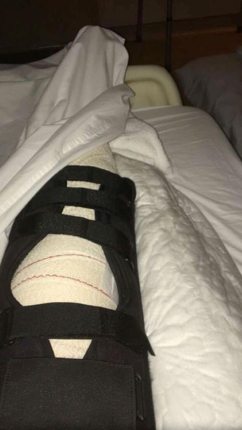 Broke Leg Snapchat, Hospital Room Snapchat Stories, Hospital Admit Hand Pics, Hospital Photography, Leg Cast, Hospital Pictures, Leg Injury, Flipagram Instagram, Hospital Photos