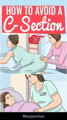 How To Avoid A C-Section (Caesarean) : Here are a few thumb rules you could also follow to help you avoid a C-Section #pregnancy #pregnant #avoid #pregnancycare #c-section Cervix Dilation Chart, Cervix Dilation, Pregnancy Info, Pregnancy Must Haves, Mom Care, Pregnancy Information, Mom Junction, New Parent Advice, Baby Prep