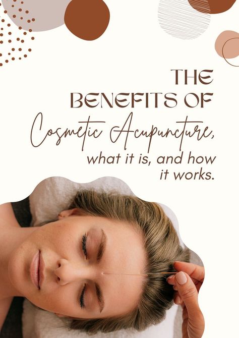 Want the best of your skin? Try acupuncture! Read this to know the benefits and why it works 😀☝ #Acupunctureforskincare #Acupunctureworks #Acupuncturebenefit #Acupuncturetip #tcm #traditionalchinesemedicine Facial Acupuncture, Skin Care Procedures, Acupuncture Benefits, For Skin Care, Traditional Chinese Medicine, Chinese Medicine, Acupuncture, Traditional Chinese, Medicine